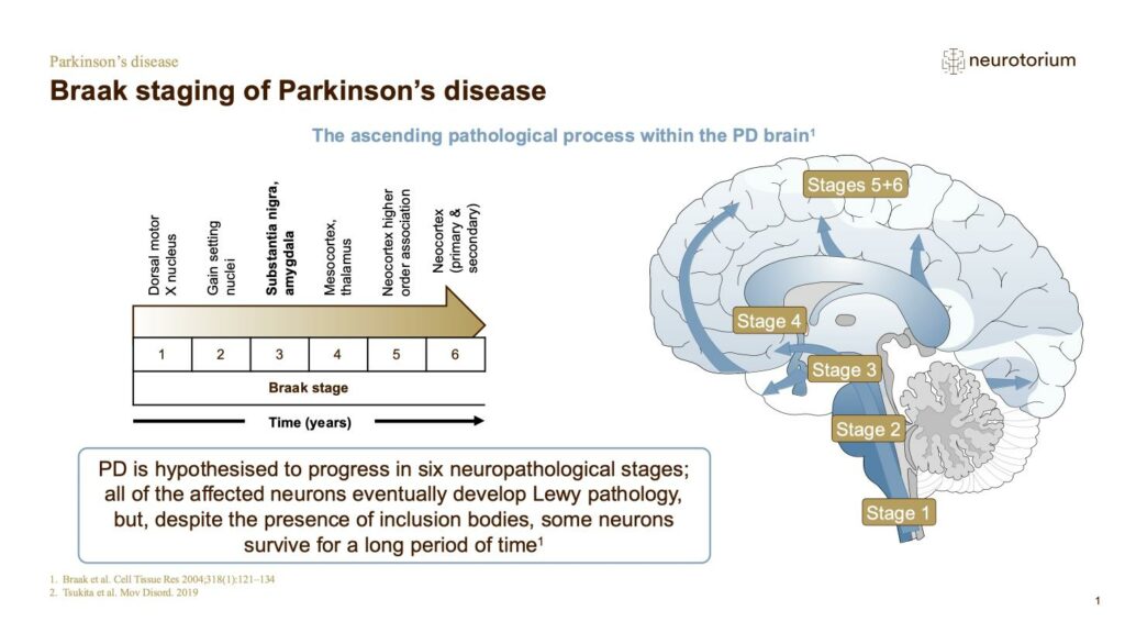 Braak staging of Parkinson’s disease